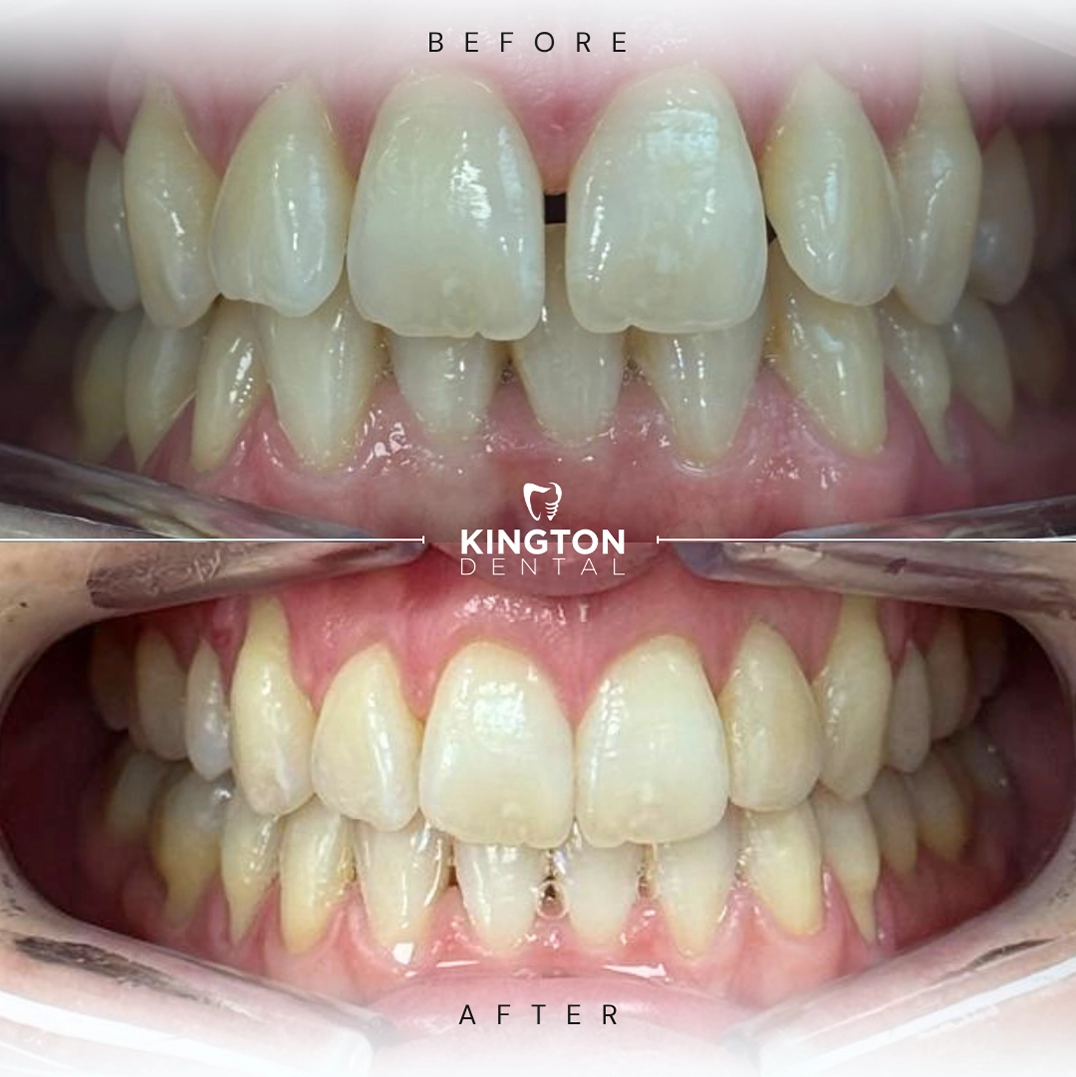 before and after dental treatment patient comparison