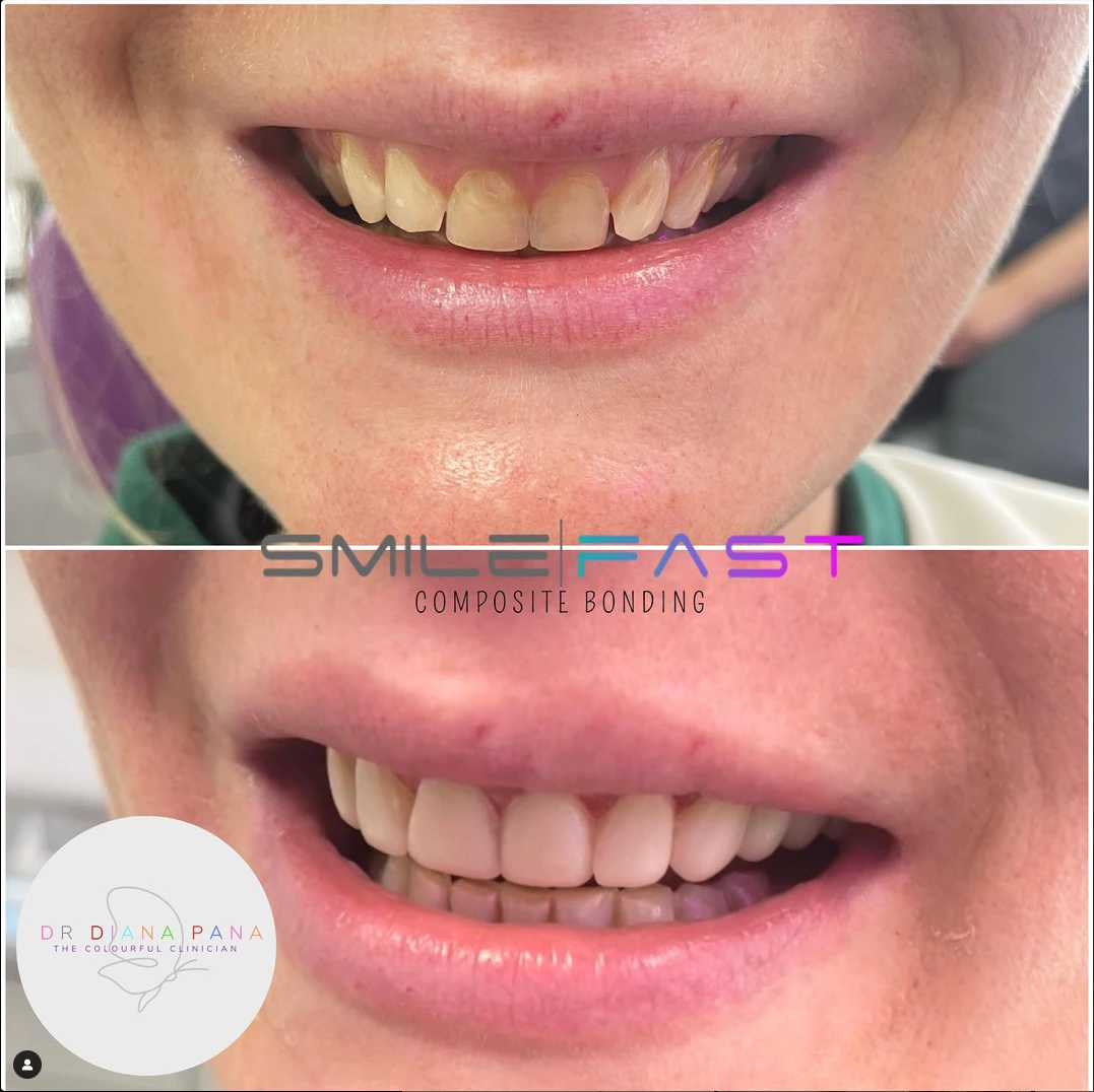 before and after dental treatment patient comparison
