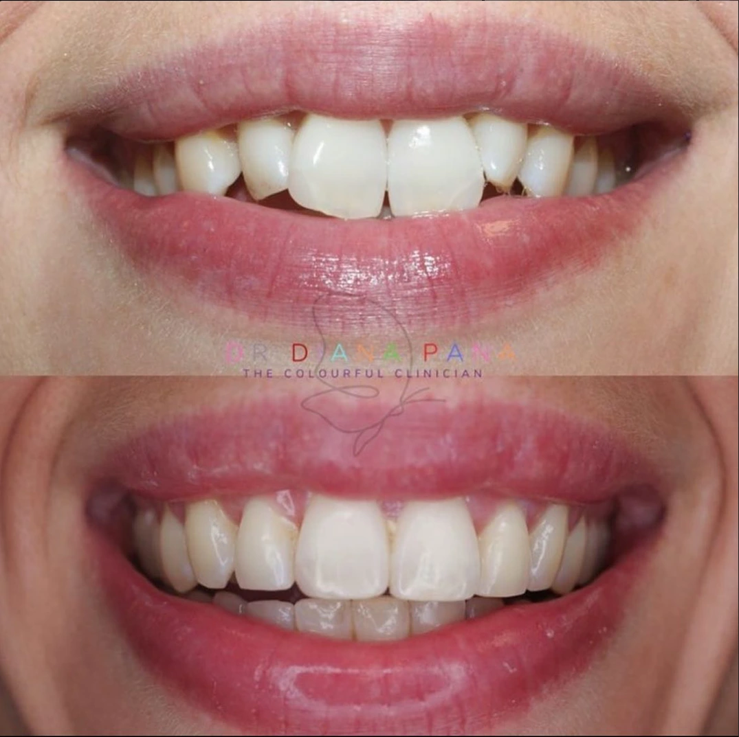 before and after dental treatment patient comparison