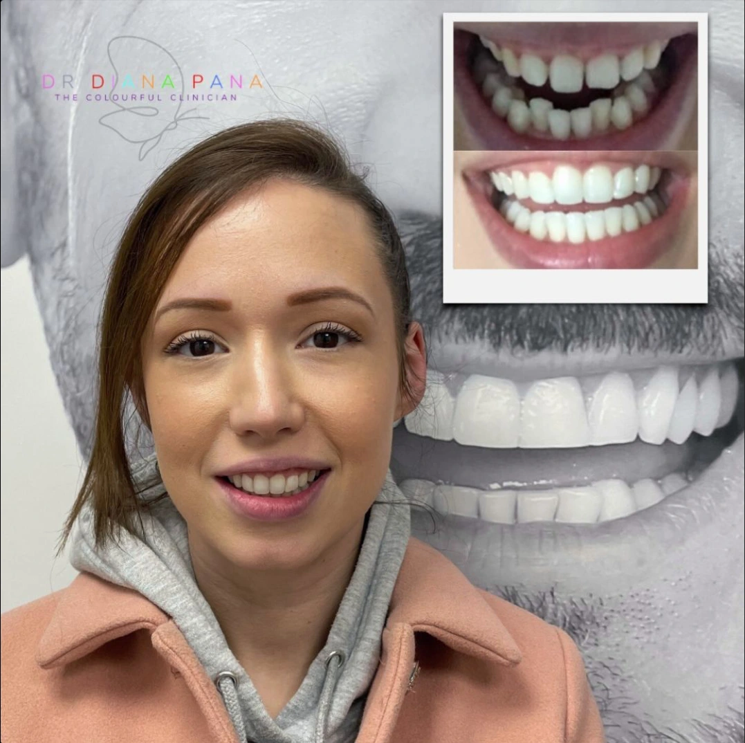 before and after dental treatment patient comparison