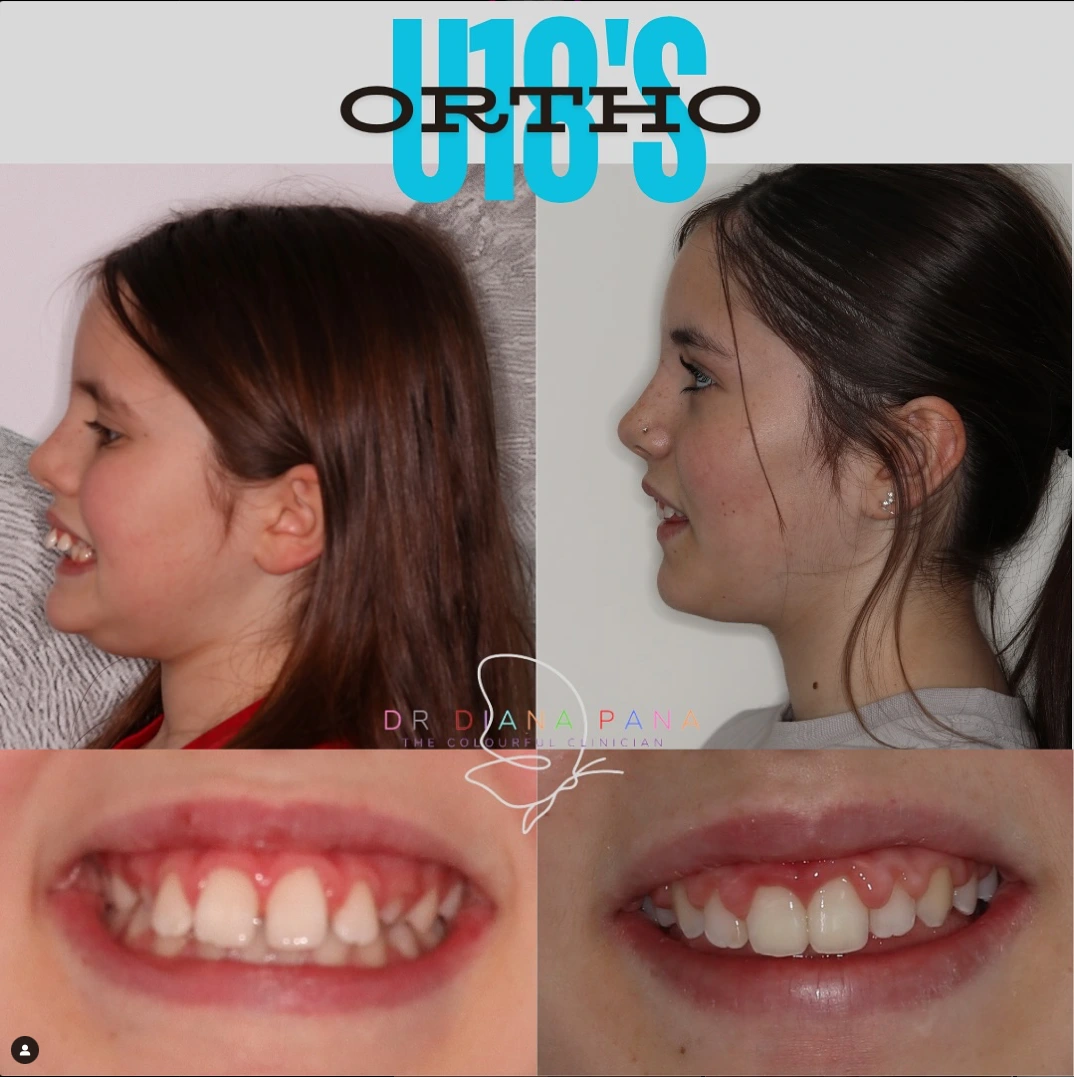 before and after dental treatment patient comparison